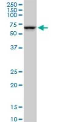 Western Blot: SMARCD2 Antibody (2C2) [H00006603-M03]