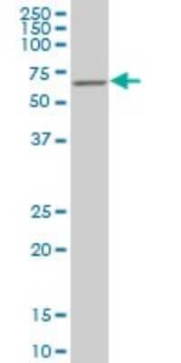 Western Blot: SMARCD2 Antibody (2C2) [H00006603-M03]