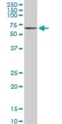 Western Blot: SMARCD2 Antibody (2C2) [H00006603-M03]