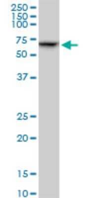 Western Blot: SMARCD2 Antibody (2C2) [H00006603-M03]