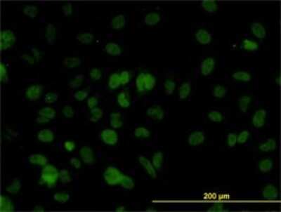 Immunocytochemistry/ Immunofluorescence: SMARCD2 Antibody (2F7) [H00006603-M01]