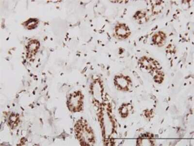 Immunohistochemistry-Paraffin: SMARCD2 Antibody (2F7) [H00006603-M01]