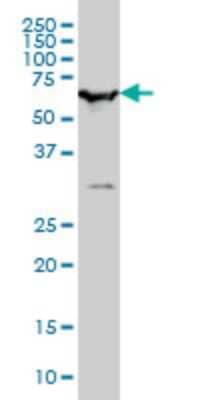 Western Blot: SMARCD2 Antibody (2F7) [H00006603-M01]