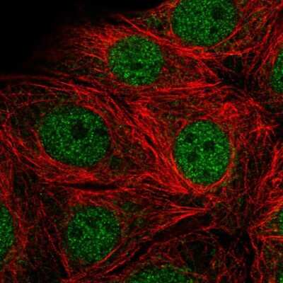 Immunocytochemistry/ Immunofluorescence: SMARCD2 Antibody [NBP2-56267]