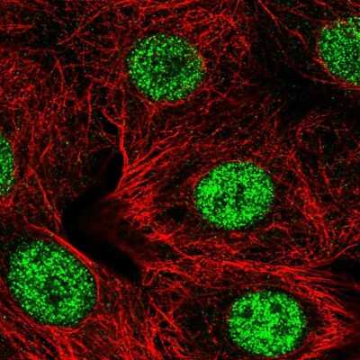 Immunocytochemistry/ Immunofluorescence: SMARCD2 Antibody [NBP2-57074]