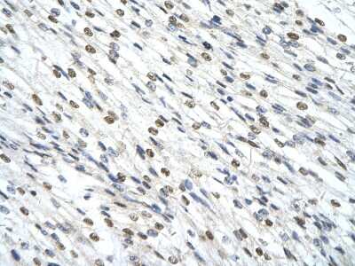 Immunohistochemistry-Paraffin: SMARCD2 Antibody [NBP3-10472]