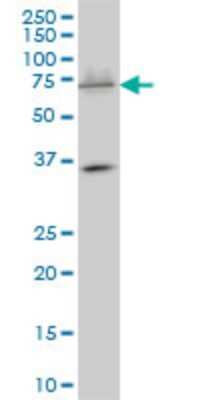 Western Blot: SMARCD3 Antibody (1G6) [H00006604-M01]