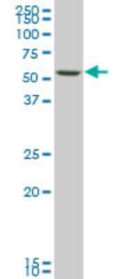 Western Blot: SMARCD3 Antibody (5B6) [H00006604-M04]