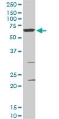 Western Blot: SMARCD3 Antibody (5F12) [H00006604-M02]