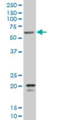 Western Blot: SMARCD3 Antibody (5F12) [H00006604-M02]