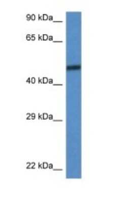 Western Blot: SMARCD3 Antibody [NBP1-79718]