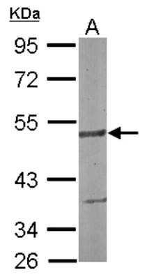 Western Blot: SMARCD3 Antibody [NBP2-15121]