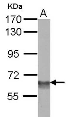 Western Blot: SMARCD3 Antibody [NBP2-15122]