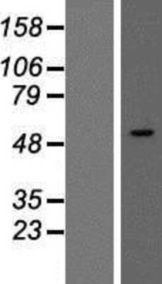 Western Blot: SMARCD3 Overexpression Lysate [NBP2-08040]