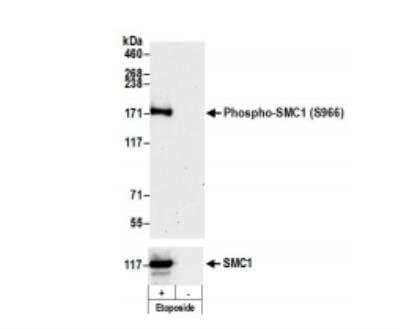 Western Blot: SMC1 [p Ser966] Antibody [NB100-206]