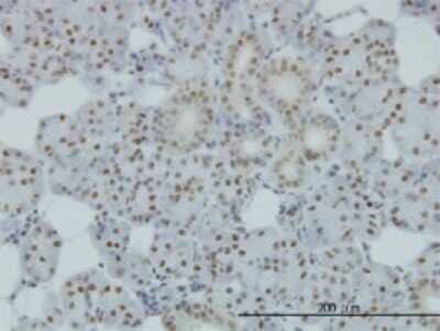 Immunohistochemistry-Paraffin: SMC1 Antibody (1B9) [H00008243-M01]