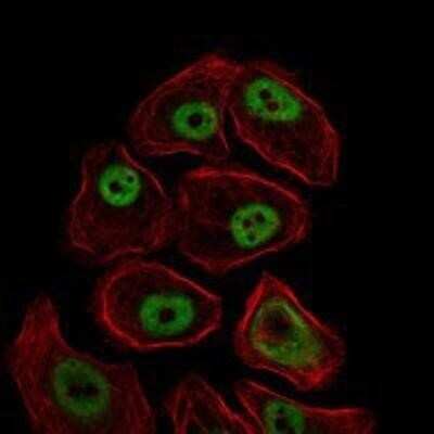 Immunocytochemistry/ Immunofluorescence: SMC1 Antibody (5B6) - BSA Free [NBP1-51596]