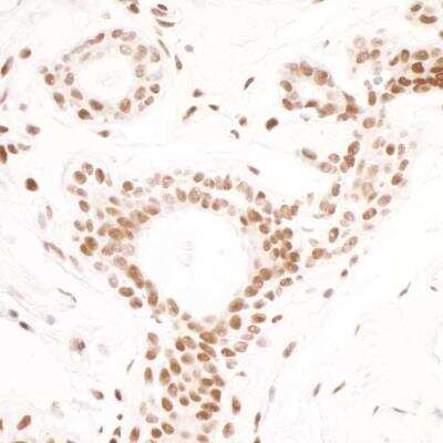 Immunohistochemistry: SMC1 Antibody (BL-205-2G8) [NBP2-76412]