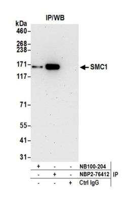 Immunoprecipitation: SMC1 Antibody (BL-205-2G8) [NBP2-76412]