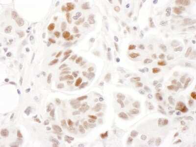 Immunohistochemistry: SMC1 Antibody [NBP2-32142]