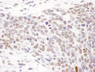 Immunohistochemistry: SMC1 Antibody [NBP2-32142]