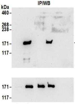 Immunoprecipitation: SMC1 Antibody [NBP2-32142]