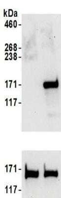 Western Blot: SMC1 Antibody [NBP2-32142]