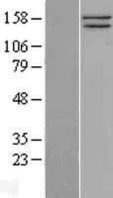 Western Blot: SMC1 Overexpression Lysate [NBL1-16236]