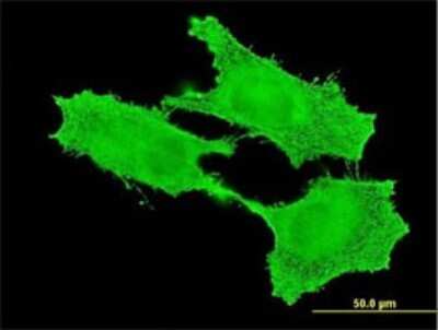 Immunocytochemistry/ Immunofluorescence: SMC1L2 Antibody (6A10) [H00027127-M01]