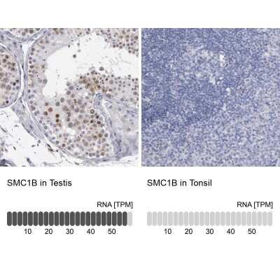 Immunohistochemistry-Paraffin: SMC1L2 Antibody [NBP1-89966]