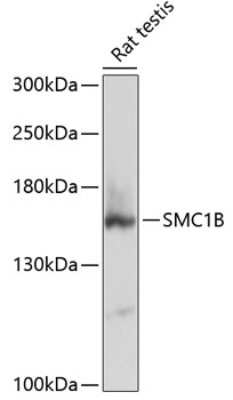 Western Blot: SMC1L2 AntibodyAzide and BSA Free [NBP2-94182]