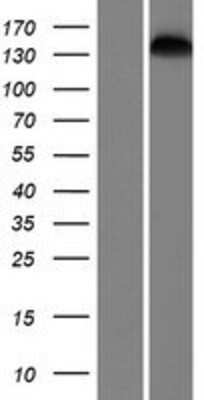 Western Blot: SMC1L2 Overexpression Lysate [NBP2-05427]