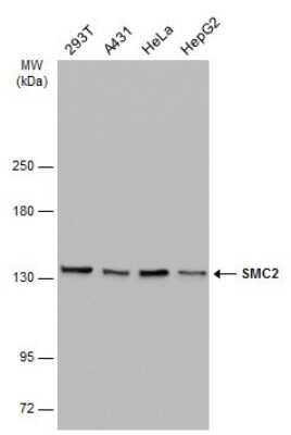 Western Blot: SMC2 Antibody (GT4312) [NBP3-13601]