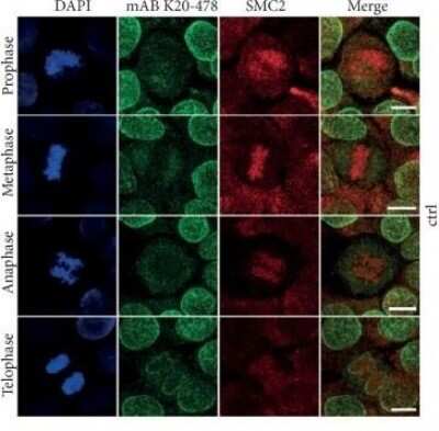 Immunocytochemistry/ Immunofluorescence: SMC2 Antibody [NB100-373]