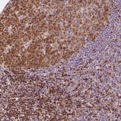 Immunohistochemistry-Paraffin: SMC2 Antibody [NBP2-49655]