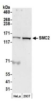 Western Blot: SMC2 Antibody [NB100-371]