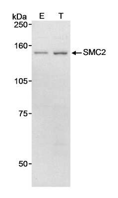 Western Blot: SMC2 Antibody [NB100-371]