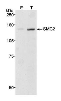 Western Blot: SMC2 Antibody [NB100-372]