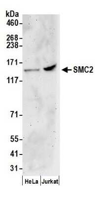 Western Blot: SMC2 Antibody [NB100-372]