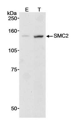 Western Blot: SMC2 Antibody [NB100-372]