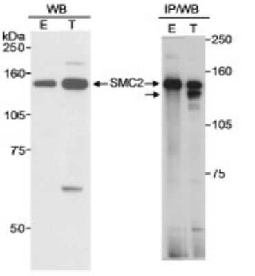 Western Blot: SMC2 Antibody [NB100-373]