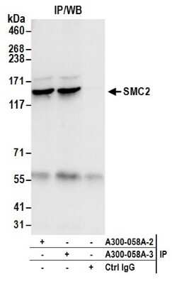 Western Blot: SMC2 Antibody [NB100-373]
