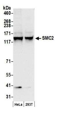 Western Blot: SMC2 Antibody [NB100-373]