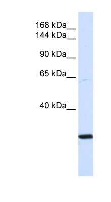 Western Blot: SMC2 Antibody [NBP1-52932]