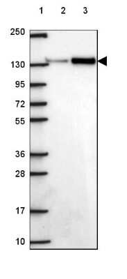 Western Blot: SMC2 Antibody [NBP2-49655]