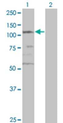 Western Blot: SMC3 Antibody (2F11) [H00009126-M02]