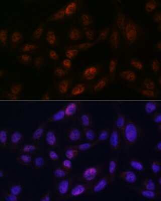 Immunocytochemistry/ Immunofluorescence: SMC3 Antibody (8W9R7) [NBP3-15798]