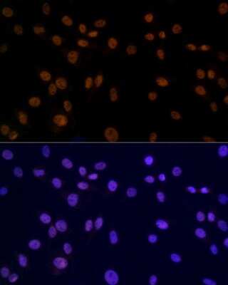 Immunocytochemistry/ Immunofluorescence: SMC3 Antibody (8W9R7) [NBP3-15798]