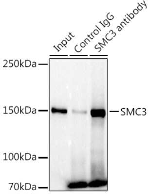 Immunoprecipitation: SMC3 Antibody (8W9R7) [NBP3-15798]
