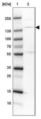 Western Blot: SMC3 Antibody [NBP1-88715]